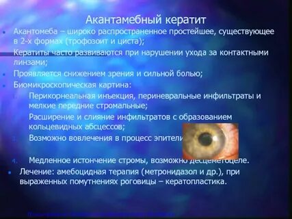Кератит лечение