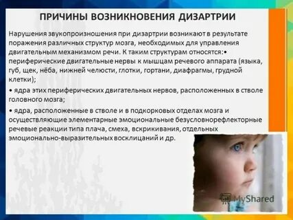Дизартрия мышц