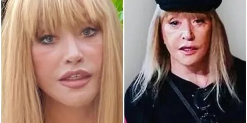 Пугачева состояние здоровья