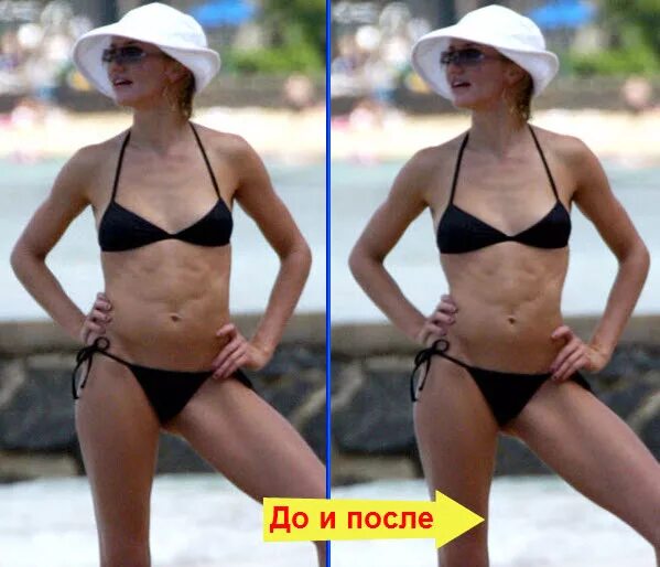 Как сузить ребра