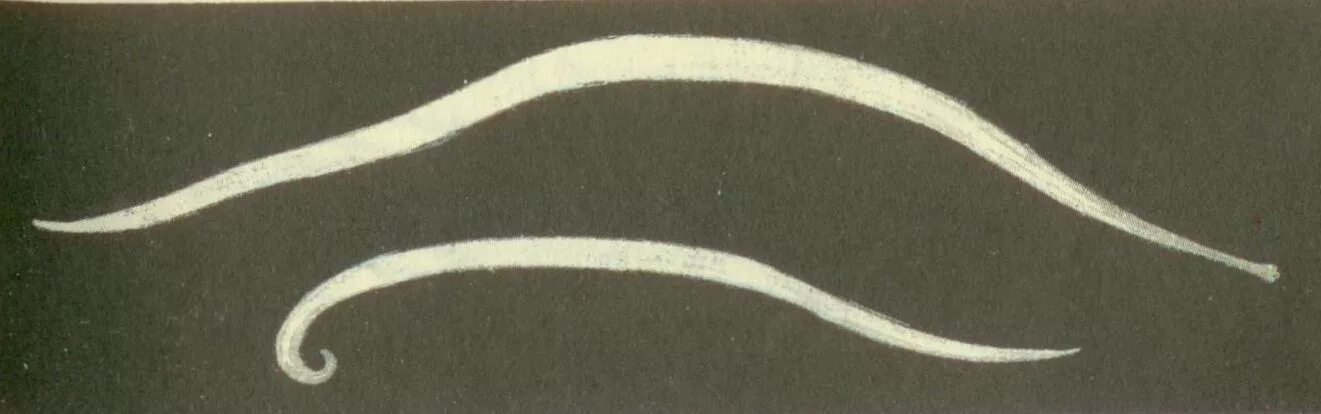 аскаридоз 1 4