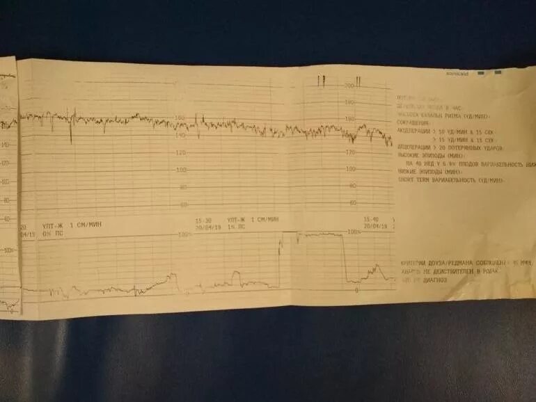 КТГ 40 недель. КТГ плода норма. КТГ при беременности 3 триместр. КТГ на 40 неделе беременности. Ктг на 40 неделе