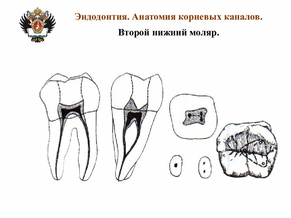 Второй моляр нижней челюсти анатомия корневых каналов. 1 Моляр нижней челюсти анатомия корневых каналов. Второй моляр верхней челюсти анатомия каналов. Нижние моляры анатомия корневых каналов второй Нижний моляр.