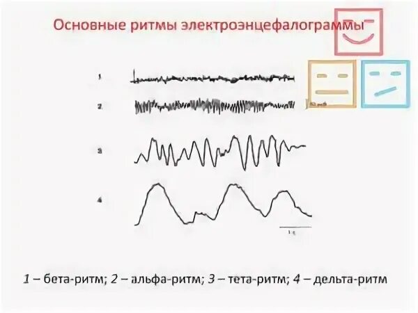 Слабомодулированный альфа ритм что значит. Ритм (ритмослоги по системе н. Ритм гитара. Ритмические упражнения для детей по сольфеджио. Ритмы читать.