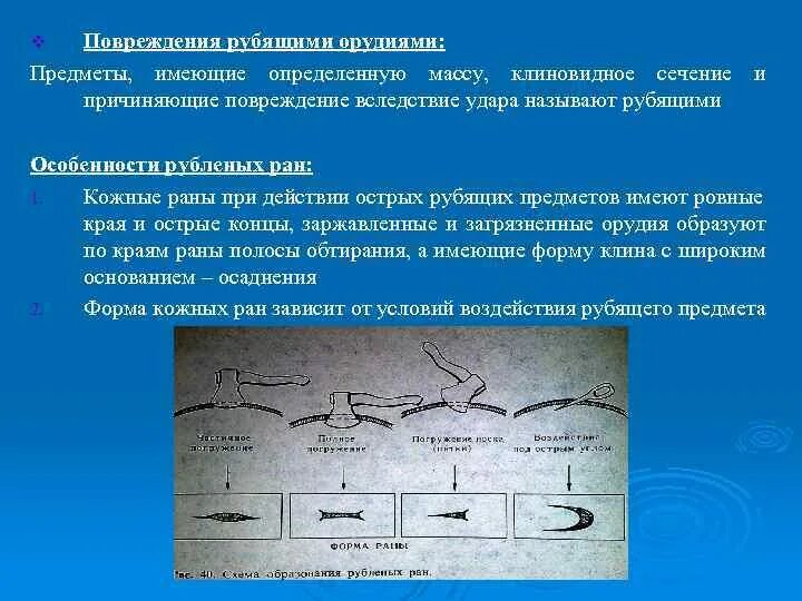 СМЭ повреждений острыми предметами. Повреждения, причиняемые острыми предметами. Повреждения острыми орудиями. Предметы повреждения орудия.