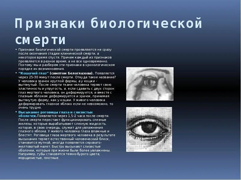 Что происходит с человеком на 9 день. Признаки клинической и биологической смерти. Признаки биологической смерти смерти. Клиническая и биологическая смерть глаза. Причины клинической и биологической смерти.