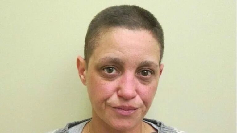 People Who Beat Cancer In Powerful Before & After Pictures