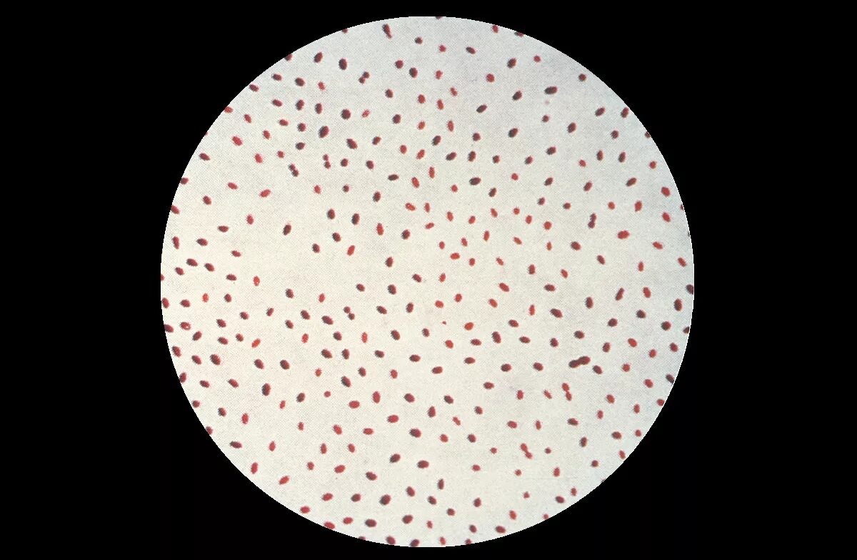Brucella spp. Brucella spp