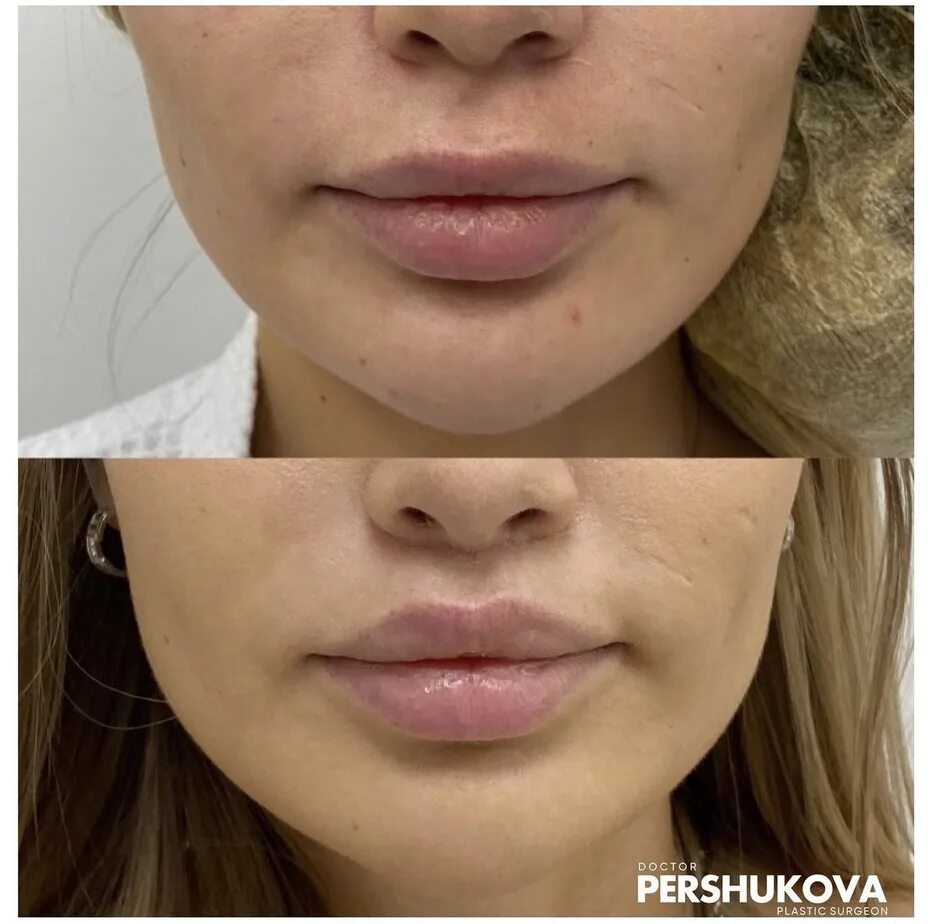 булхорн это