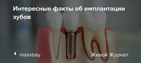 Антибиотики после имплантации