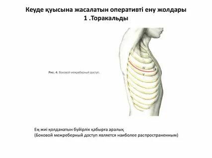 Тар бел және үлкен кеуде