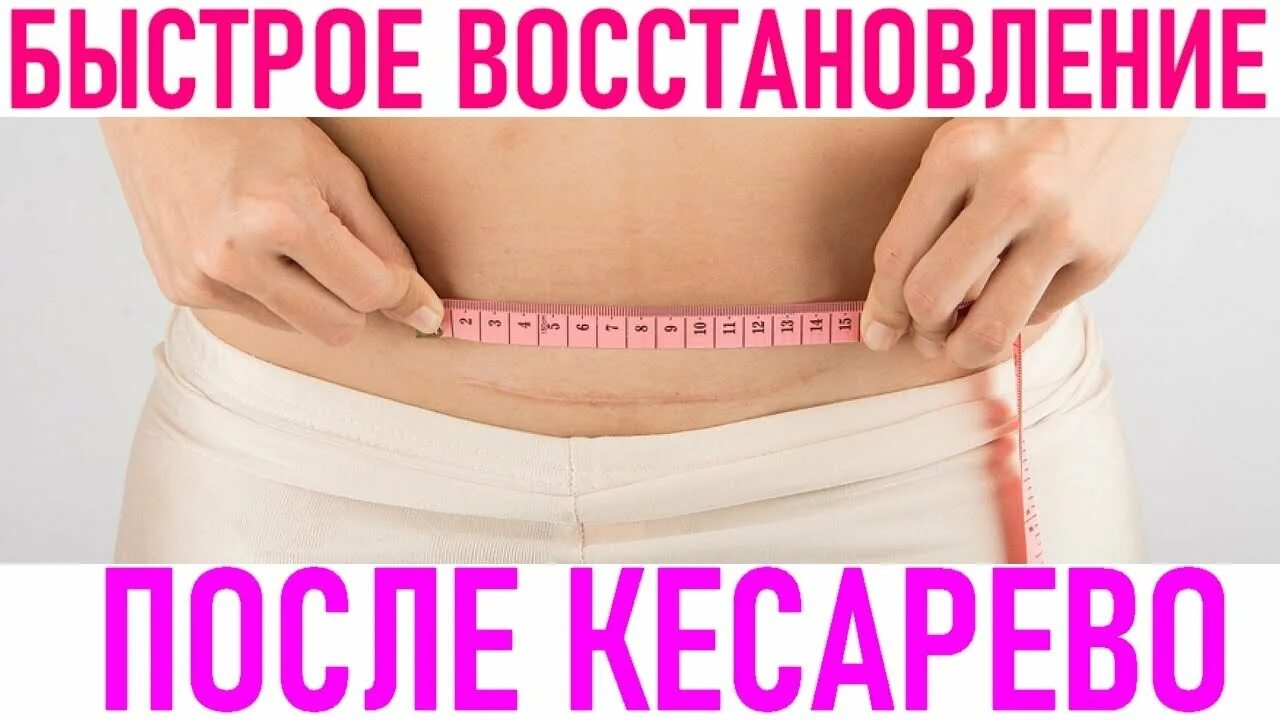 Как быстро восстановиться после кесарева сечения. Восстановление после кесарево сечение. восстановление после кесарево. тейпирование после кесарево. реабилитация после кесарева сечения.
