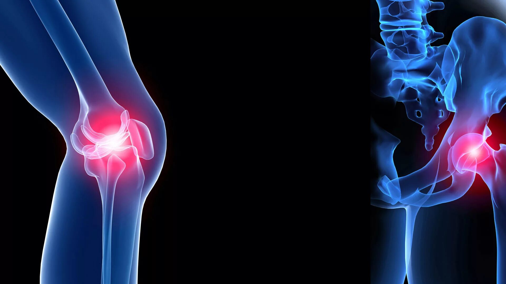 Болезнь суставов коленей. Остеоартроз травматология. Красивый сустав.