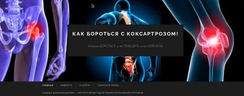 Кто лечит коксартроз
