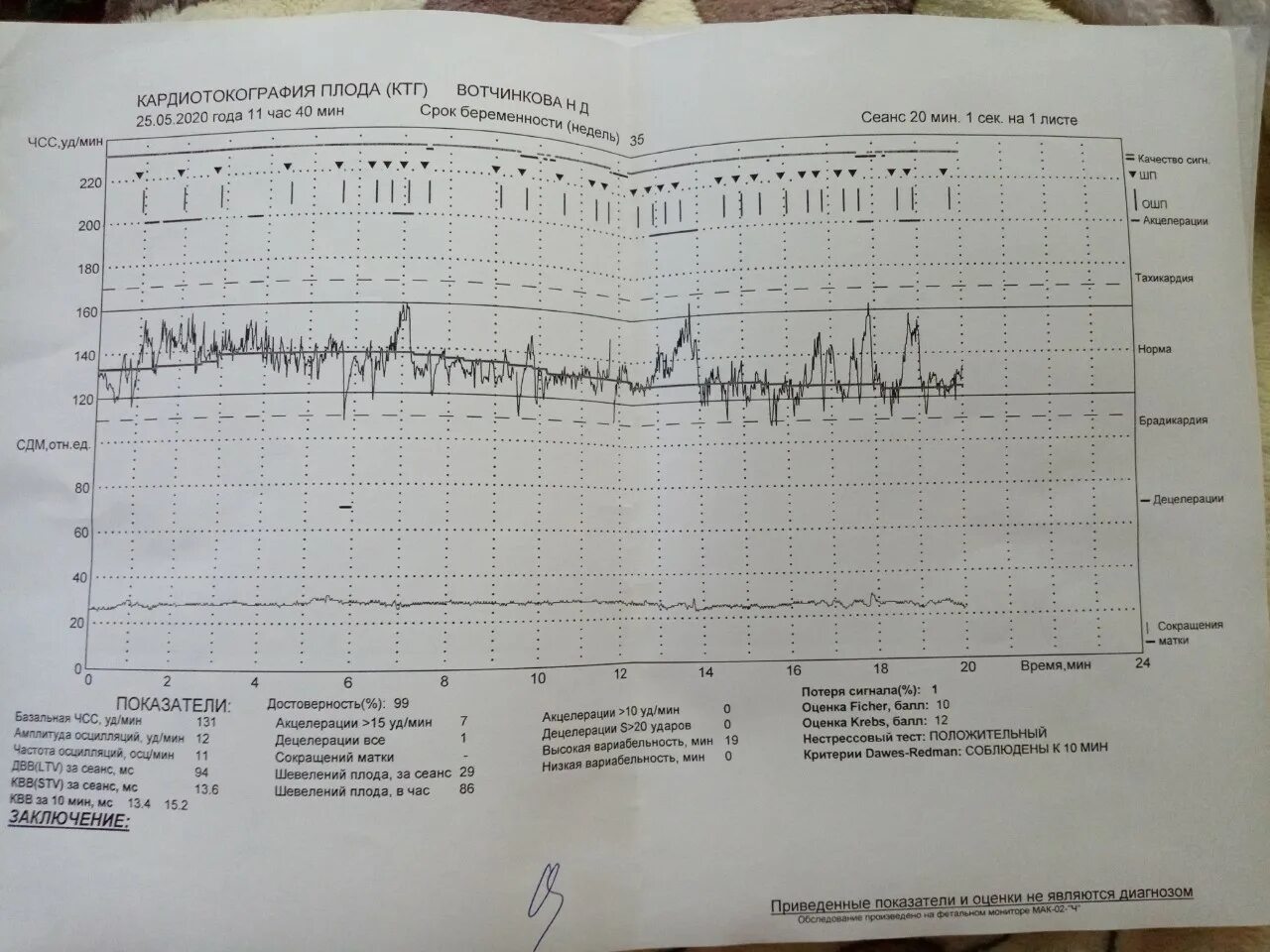 КТГ при беременности 37 недель норма таблица. Маточный датчик КТГ норма. КТГ постановка датчиков. Оценка состояния плода методом КТГ.