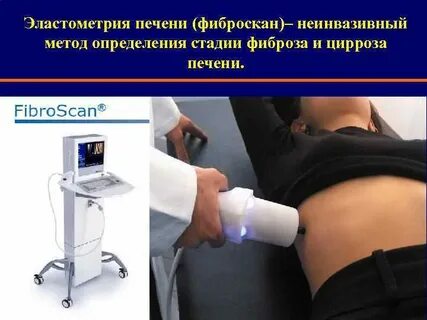 Подготовка к фиброэластометрия печени