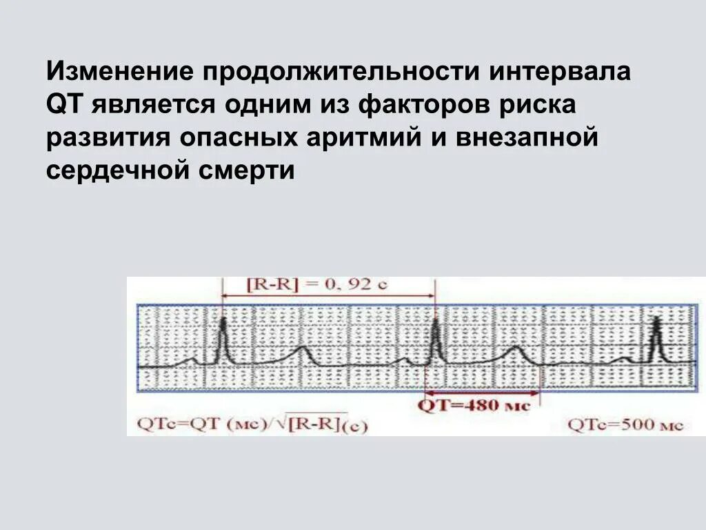 Увеличение интервала pq. Интервалы PQ И qt в ЭКГ. Синдром удлиненного интервала qt на ЭКГ. Нормальный интервал qt на ЭКГ норма. Qt QTC на ЭКГ норма.