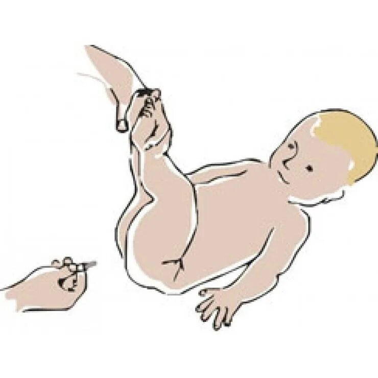 Пук новорожденных. Позы для отхождения газов у новорожденных. Клизмочку для новорожденного ребенка. ГАЗЫ У грудничка.