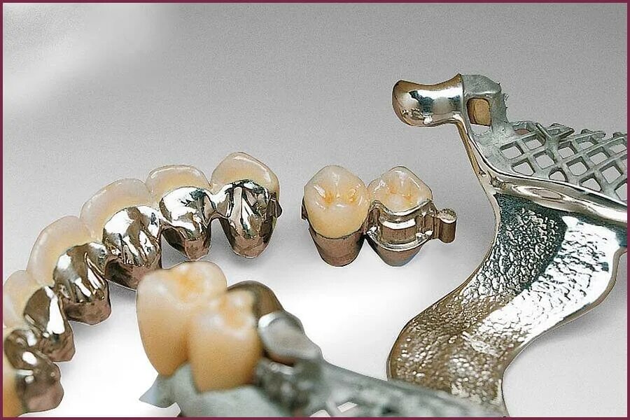 Сколько стоит металлические зубы. Коронка цельнолитая (сплав remanium). Кобальто хромовый сплав в стоматологии. Сплав кобальт хром бюгельный протез. Коронка цельнолитая (никель хром).
