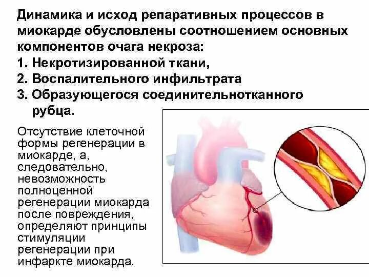 Комплекс qrs отражает процесс:. Процессы в миокарде. Процессы в миокарде. Нарушенияметаболищма миокарда. Диффузное поражение миокарда экг.
