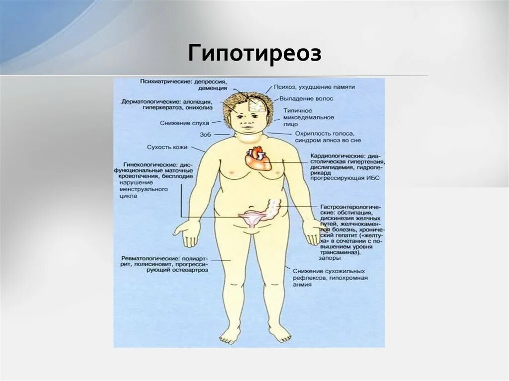 Кожа при гипотиреозе. Гипотиреоз симптомы на коже.