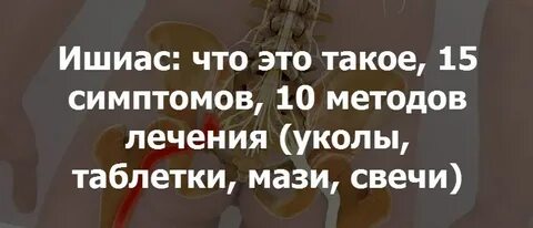 Ишиаз лечение
