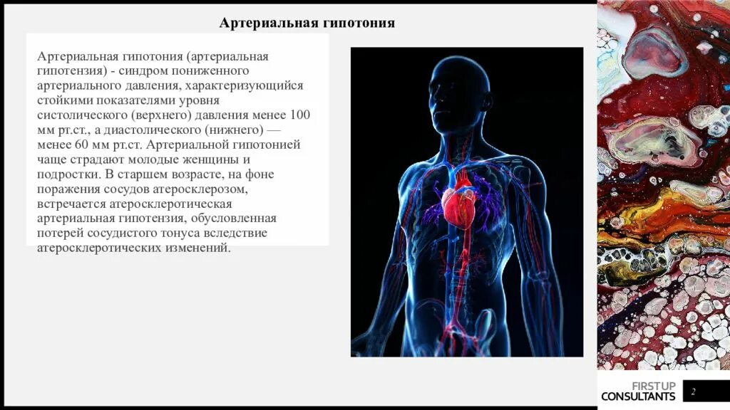 Гипотония сосудов. Артериальная гипотония. Сестринский процесс при артериальной гипотензии. Сестринский процесс при гипотонии. Синдром артериальной гипотонии.