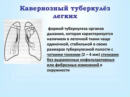 Течение кавернозного туберкулеза