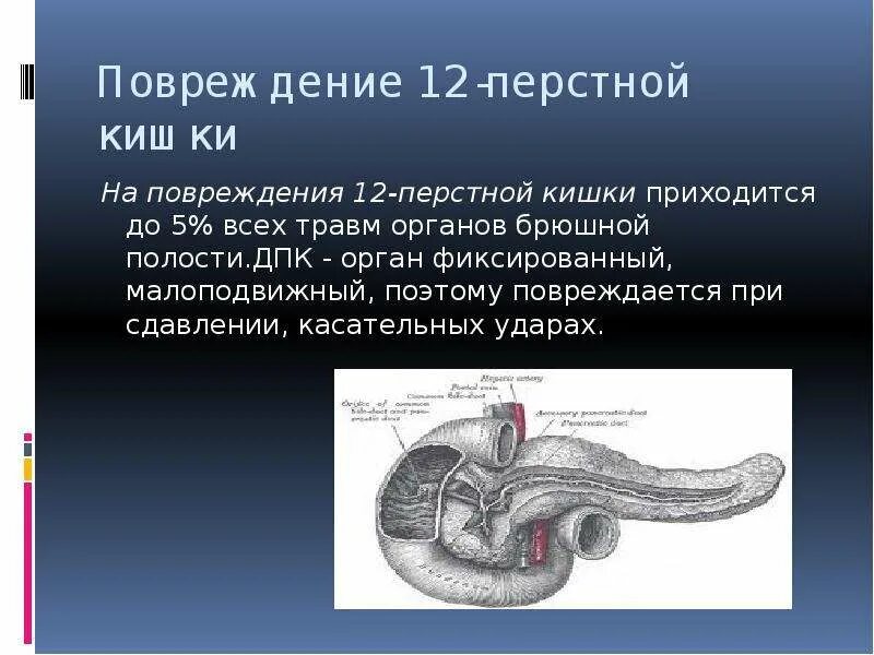 Разрыв 12 перстной кишки. Луковица 12 перстной кишки анатомия.