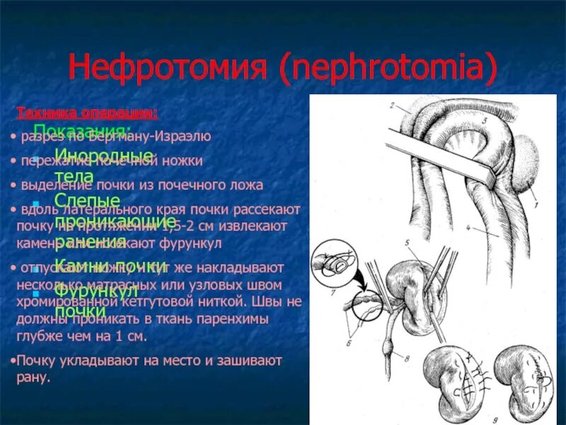 Рассечение термин