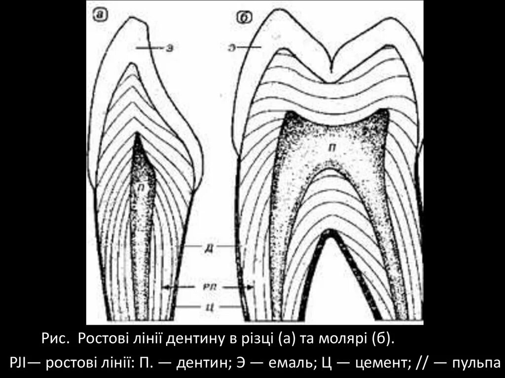 Дентин зуба образуется из. Первичный и вторичный дентин. линии оуэна дентин. вторичный и третичный дентин.