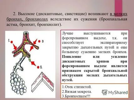 На выдохе свистящие хрипы
