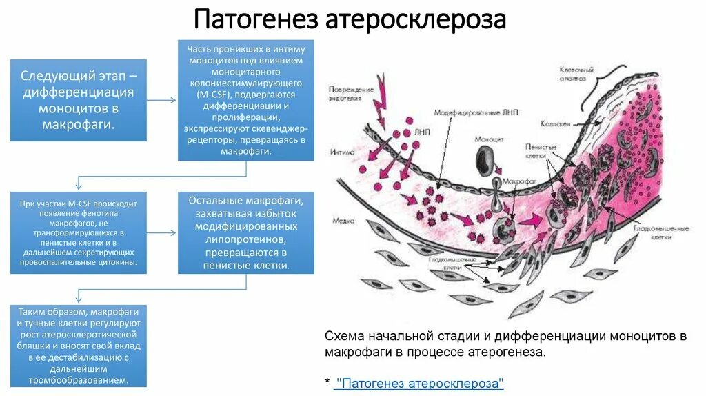 Стадии атеросклероза артерий. Стадии атеросклероза артерий