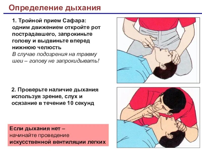 Положение реанимации. Слр тройной прием сафара. сердечно легочная реанимация тройной прием сафара. прием сафара при сердечно легочной реанимации. выполнение тройного приема сафара.