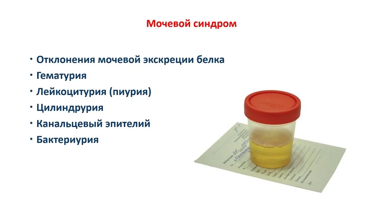 Как сдавать мочу на анализ мужчине. Сколько мочи надо для анализа. Сколько мочи нужно для исследования. Сколько нужно мочи для общего анализа. Баночка для мочи.