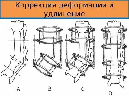 Исправление деформаций