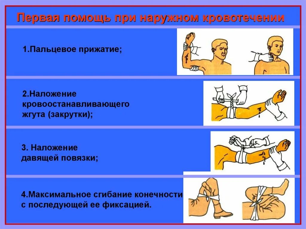 Оказание первой помощи при кровотечении. Оказание первой помощи при кровотечениях и травмах. Оказание 1 помощи при кровотечении. Схема оказания первой помощи при кровотечениях.