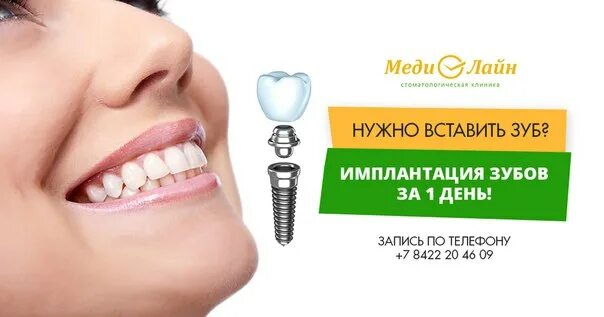 Вставить зубы вологда