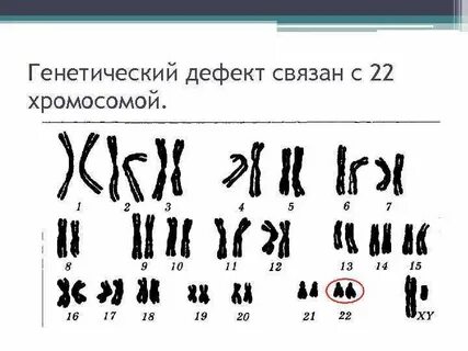 22 хромосома