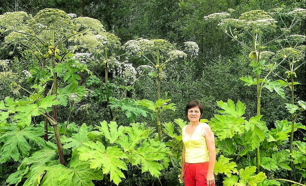 Ожог от лопуха. Растение борщевик сосновского. борщевик сосновского ожоги. борщевик сосновского волдыри. борщевик сибирский листья.