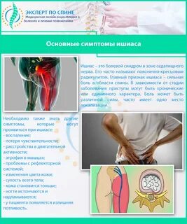 Миорелаксанты при седалищном нерве