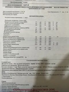 Длина костей