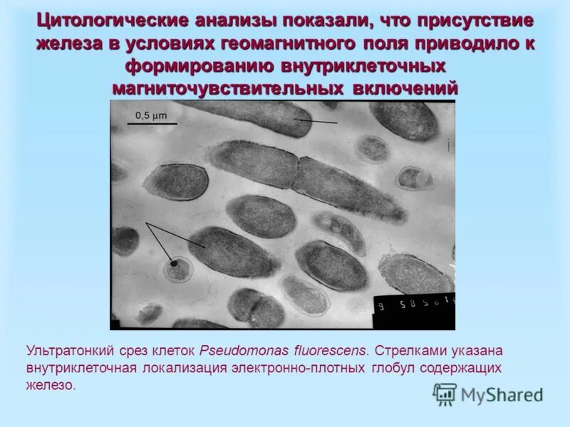 Электронно плотный. Электронно плотный