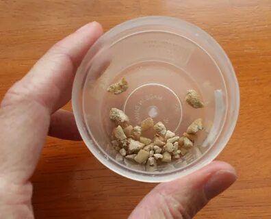 Почему выходят камни