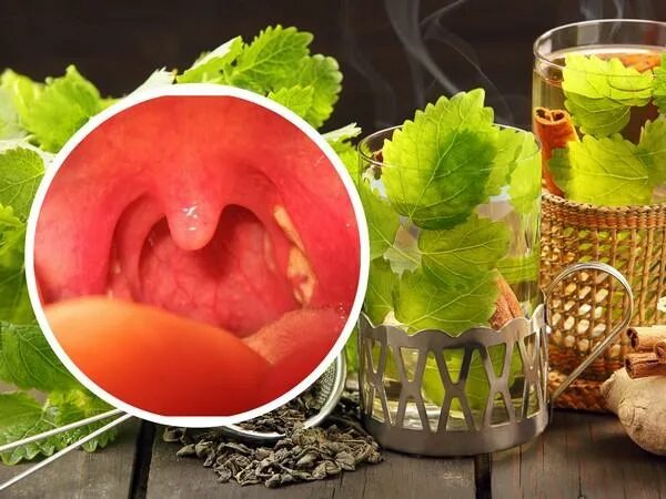 Как быстро вылечить гнойную