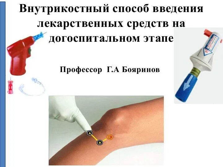 Внутрикостное введение лекарственных. Внутрикостный способ введения лекарственных средств. внутрикостный катетер. внутрикостный путь введения лекарств. методика внутрикостного введения.