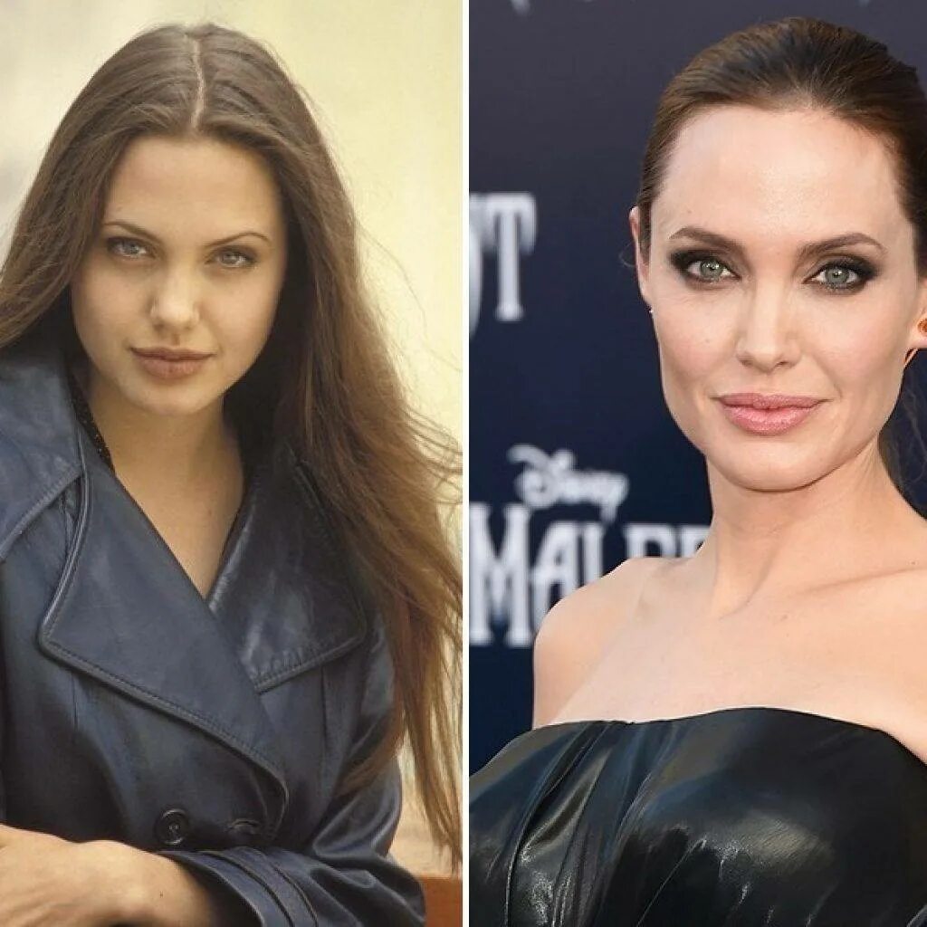 Анджелина Джоли скулы в молодости. Анджелина Джоли пластические операции. Анжелина Джоли до и после пластики. Анджелина джоли до пластики