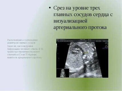 Срез через