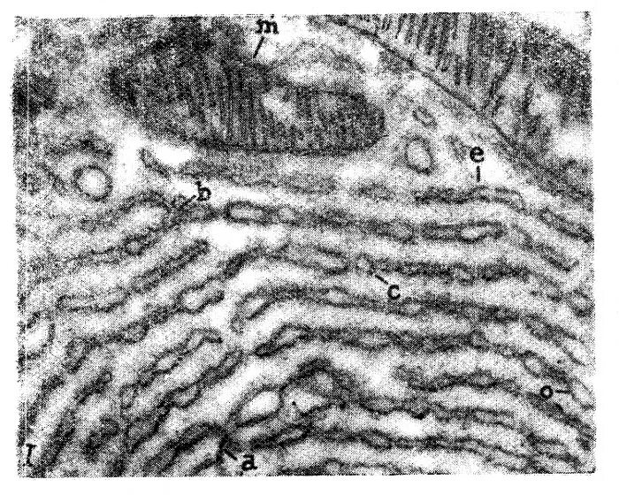 электронная микрофотография панкреатита гистология. вакуоль электронная микрофотография. рибосомы микрофотография. лейкопласты микрофотография. висцеральный лейшманиоз микроскопом.