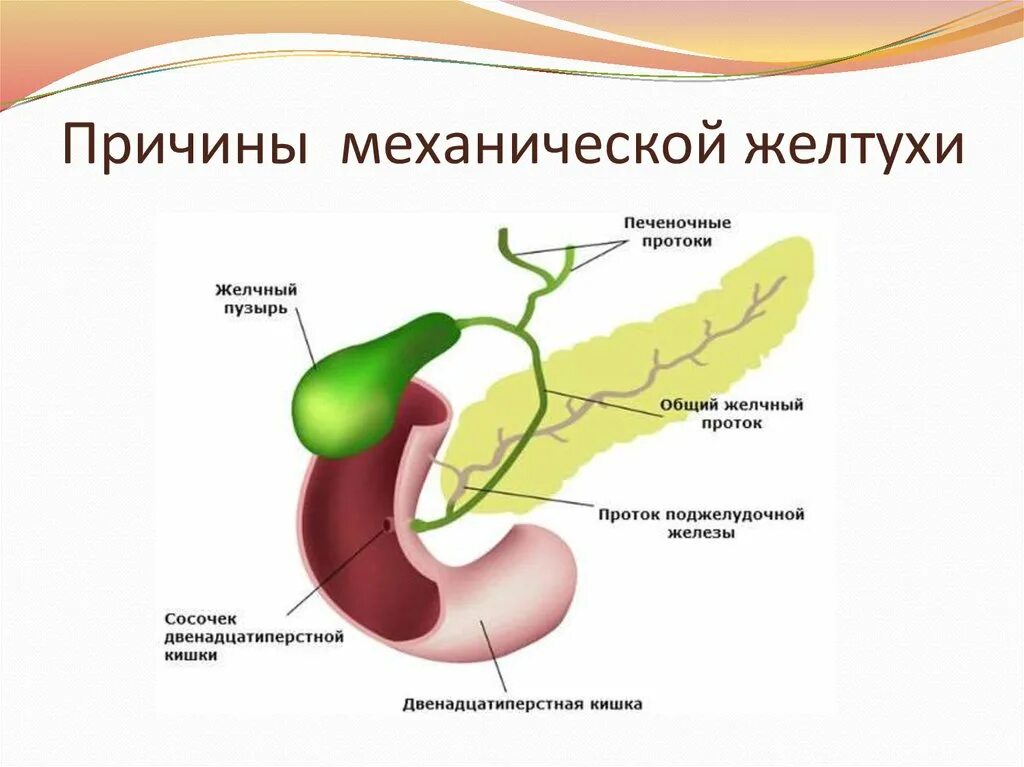 Увеличенный желчный пузырь причины